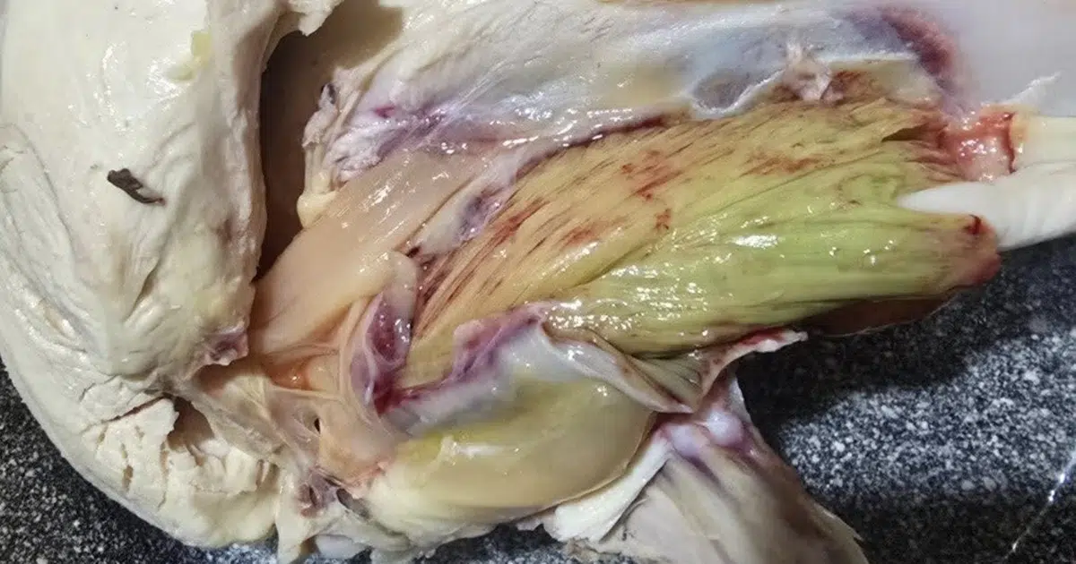 Green Meat in Chicken: Is It Dangerous, Spoiled, or Safe to Eat?
